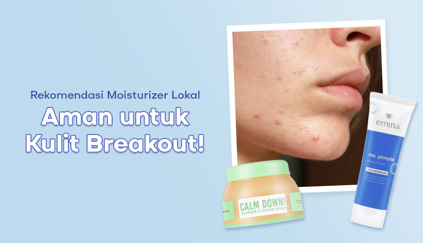 Anti Jerawat Ngamuk! Ini Rekomendasi Moisturizer Lokal yang Aman Digunakan saat Breakout