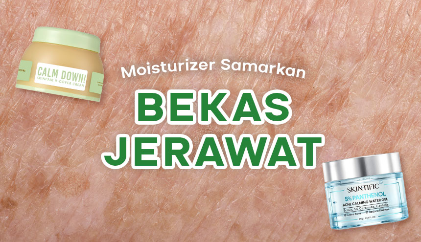 Kulit Sehat No Drama: Moisturizer untuk Samarkan Bekas Jerawat!
